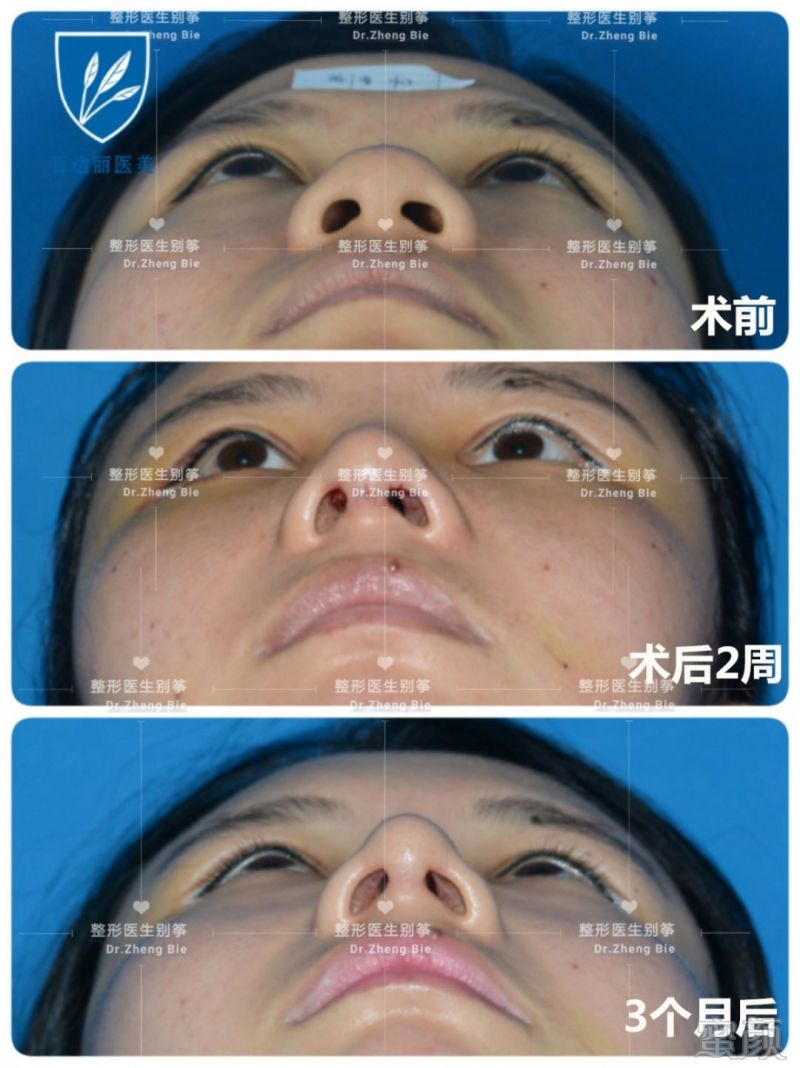 https://img.miyanlife.com/mnt/timg/190726/114PM5B-4.jpg