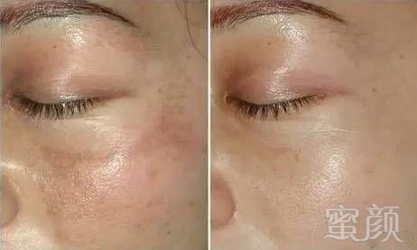 https://img.miyanlife.com/mnt/timg/190727/1109455G9-3.jpg