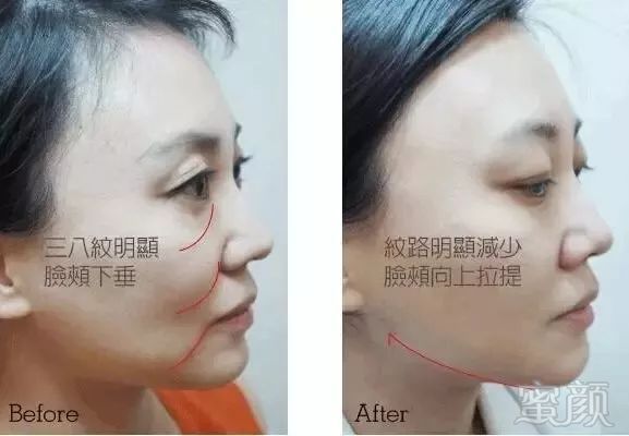 https://img.miyanlife.com/mnt/timg/190727/110F44G1-2.jpg