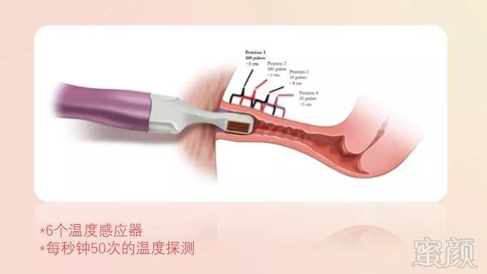 https://img.miyanlife.com/mnt/timg/190727/1111546450-3.jpg