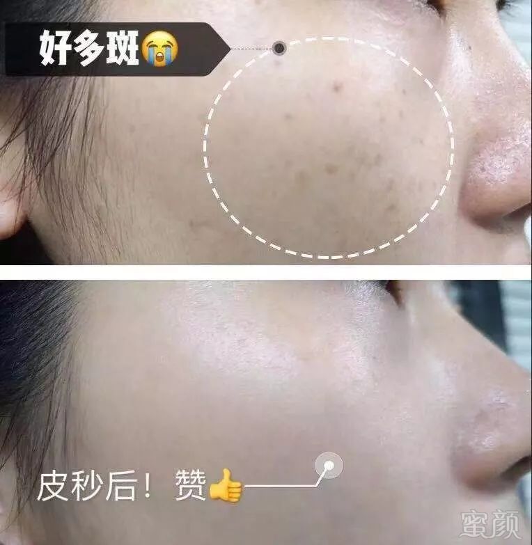 https://img.miyanlife.com/mnt/timg/190727/1114205X3-7.jpg