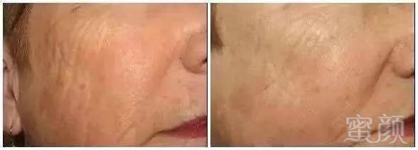 https://img.miyanlife.com/mnt/timg/190727/1114213016-10.jpg