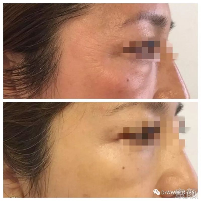 https://img.miyanlife.com/mnt/timg/190727/111R03048-0.jpg