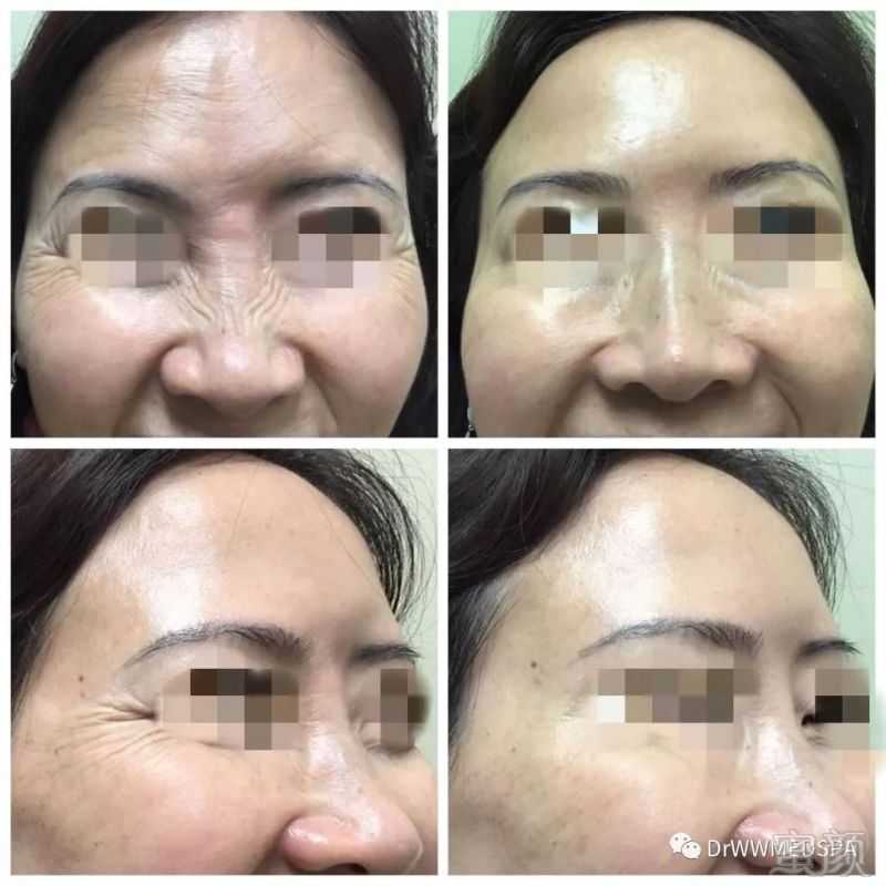 https://img.miyanlife.com/mnt/timg/190727/111R11363-2.jpg
