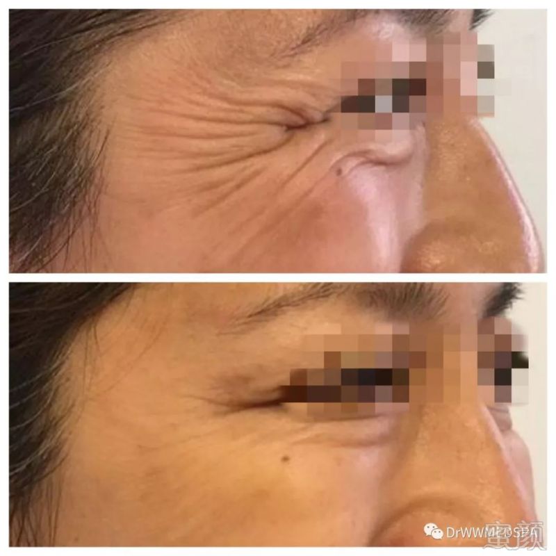 https://img.miyanlife.com/mnt/timg/190727/111R14291-1.jpg