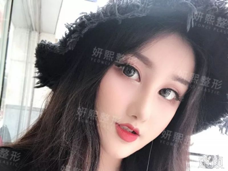 https://img.miyanlife.com/mnt/timg/190727/12235045Z-4.jpg