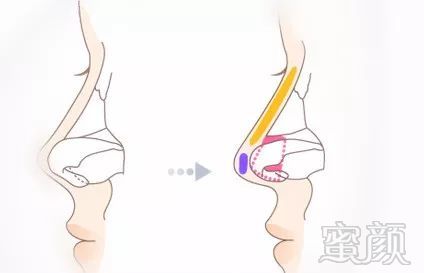 https://img.miyanlife.com/mnt/timg/190727/12405SA4-6.jpg