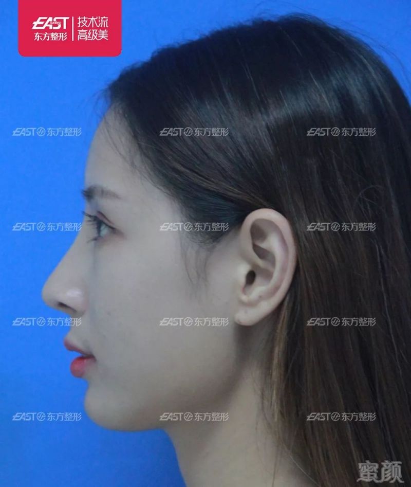 https://img.miyanlife.com/mnt/timg/190727/124102JW-13.jpg