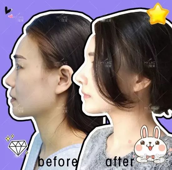 https://img.miyanlife.com/mnt/timg/190727/12443J2O-13.jpg