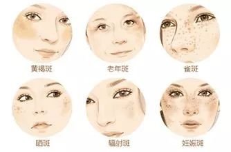 https://img.miyanlife.com/mnt/timg/190728/11024W944-1.jpg