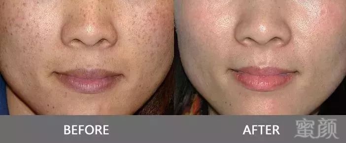 https://img.miyanlife.com/mnt/timg/190728/1103034606-15.jpg