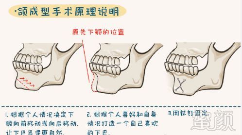 案例图片