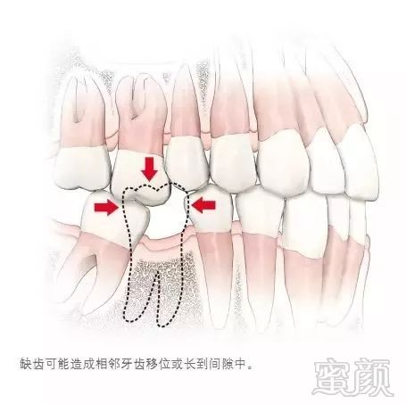 案例图片