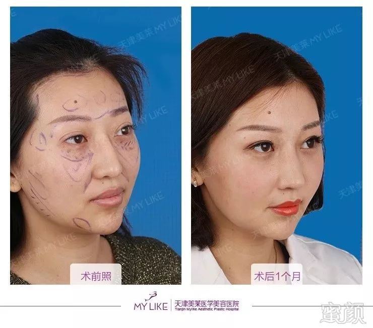 https://img.miyanlife.com/mnt/timg/190728/11395Q540-2.jpg