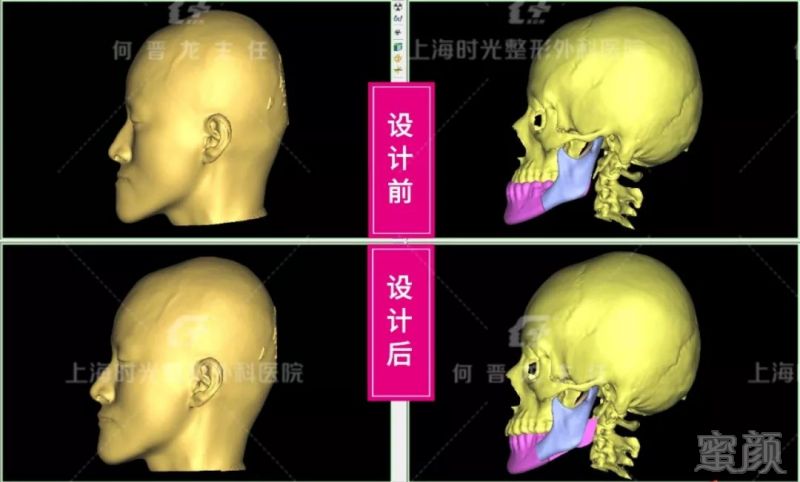 案例图片