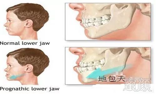 案例图片