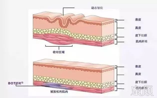 案例图片