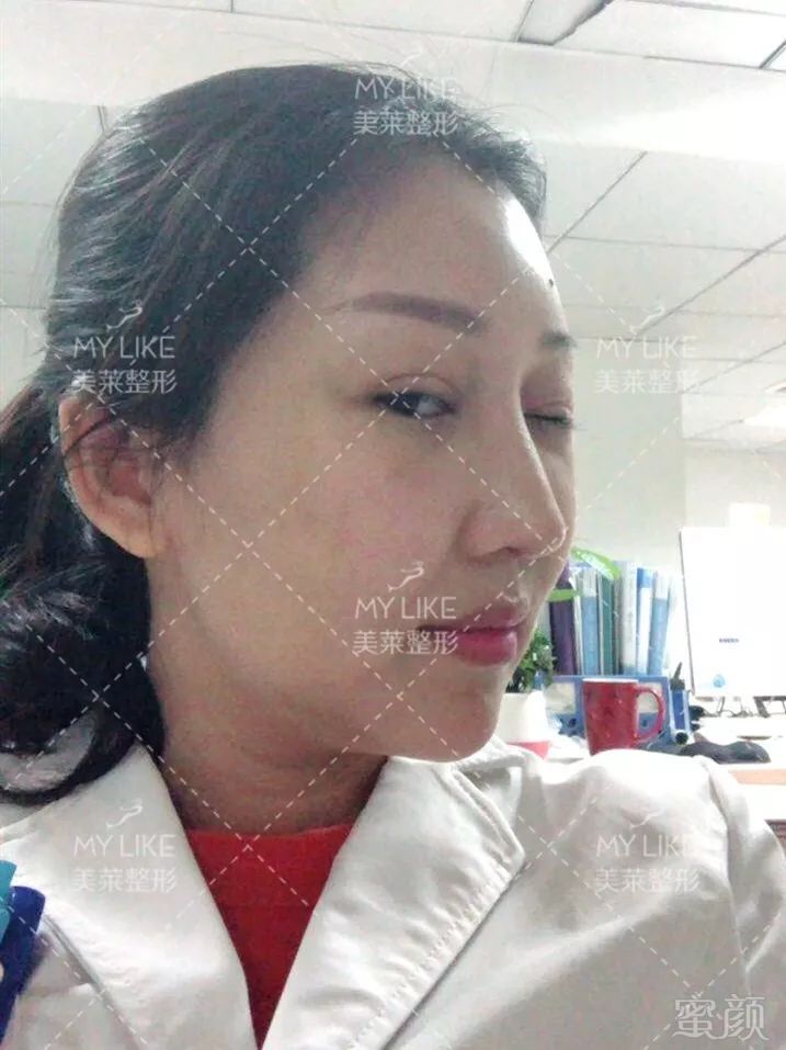 https://img.miyanlife.com/mnt/timg/190728/1140025152-6.jpg