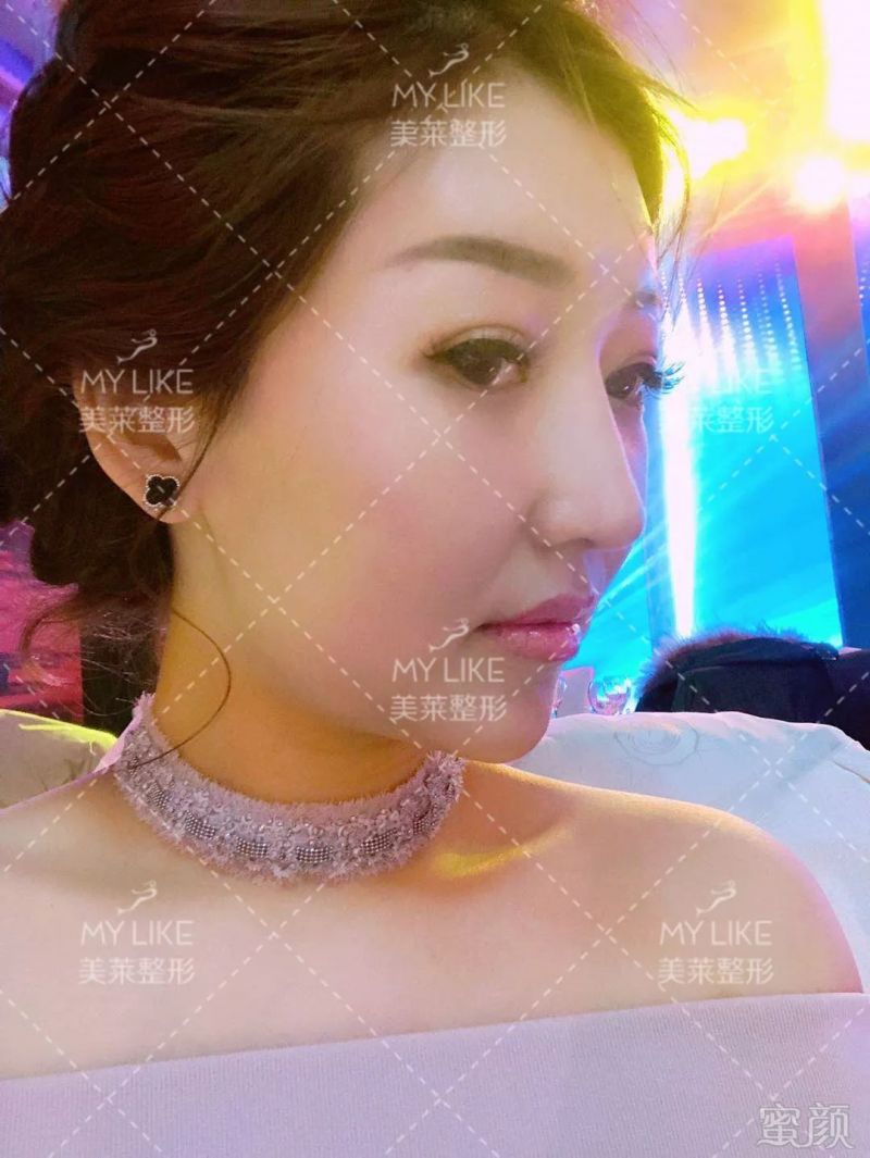 https://img.miyanlife.com/mnt/timg/190728/11401GR1-14.jpg
