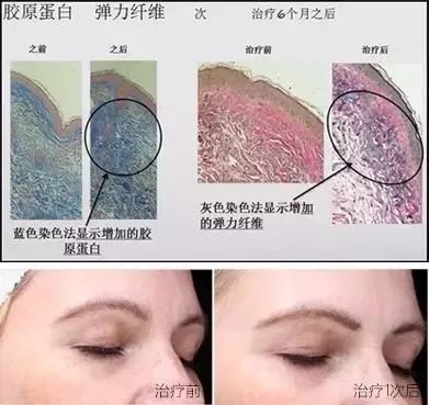 https://img.miyanlife.com/mnt/timg/190729/11393UP4-9.jpg