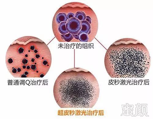 https://img.miyanlife.com/mnt/timg/190729/113Ka4D-2.jpg