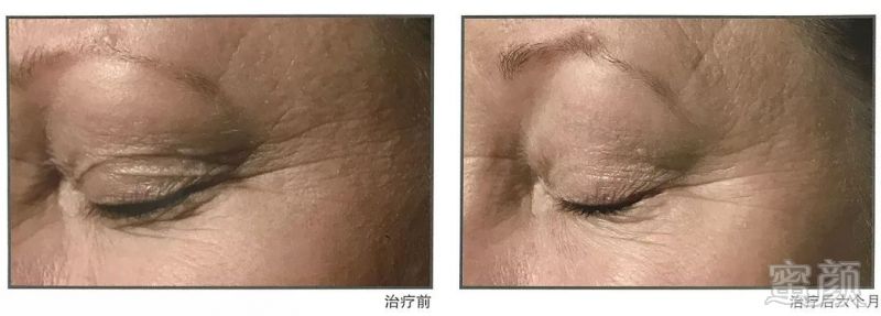 https://img.miyanlife.com/mnt/timg/190729/11452TY5-8.jpg