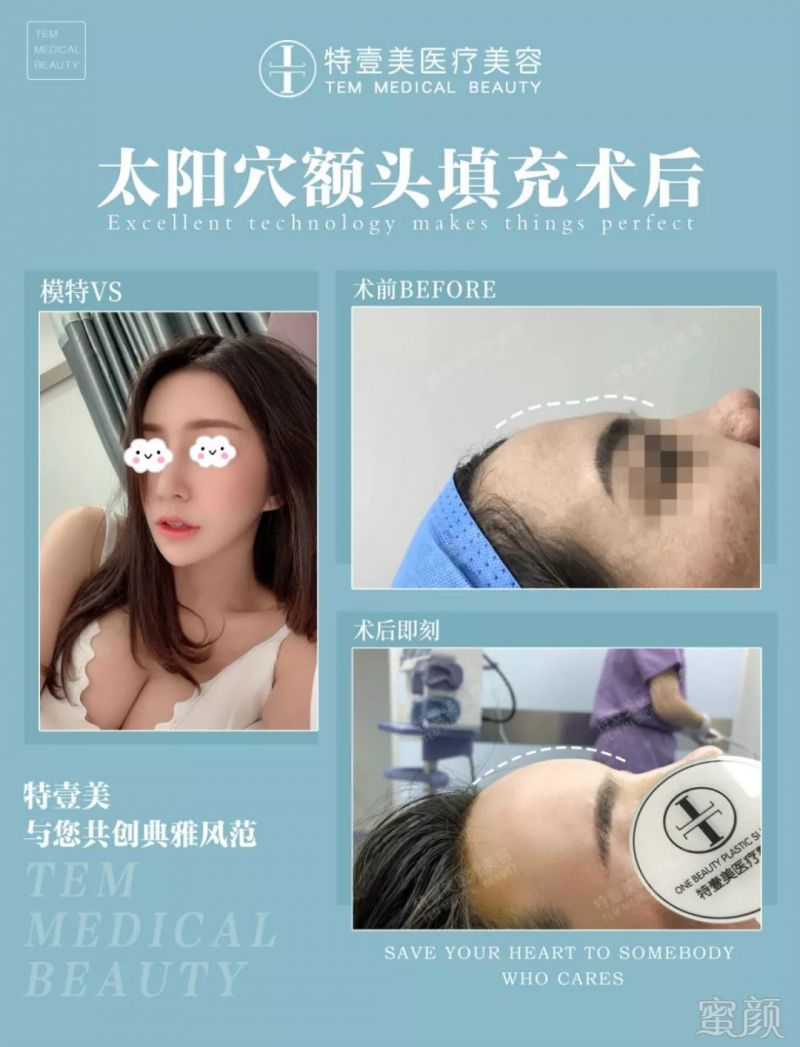 https://img.miyanlife.com/mnt/timg/190729/1201064Q0-5.jpg