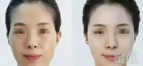 https://img.miyanlife.com/mnt/timg/190729/12013I2F-5.jpg