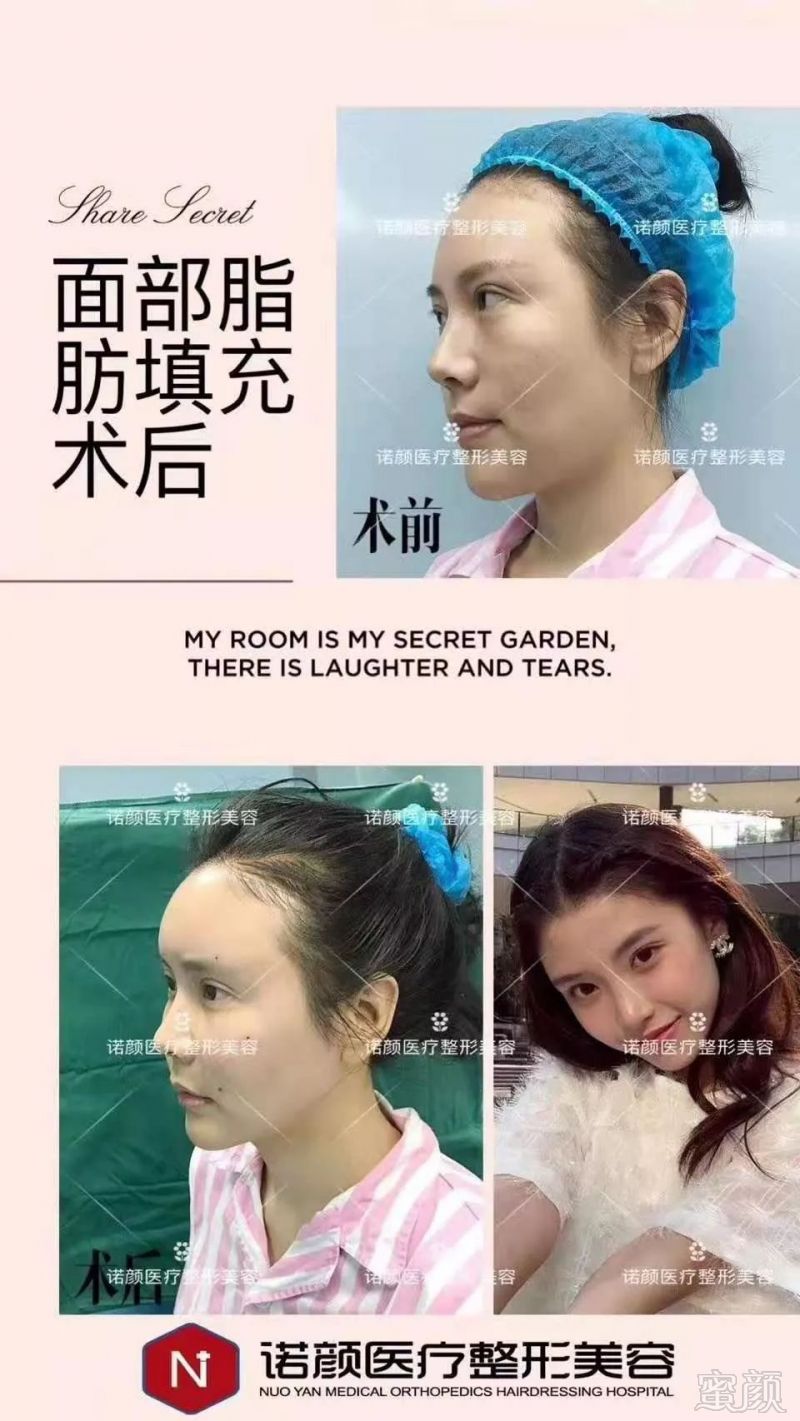 https://img.miyanlife.com/mnt/timg/190729/12013S928-9.jpg
