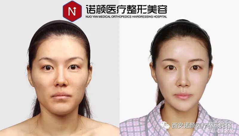 https://img.miyanlife.com/mnt/timg/190729/12013a212-10.jpg