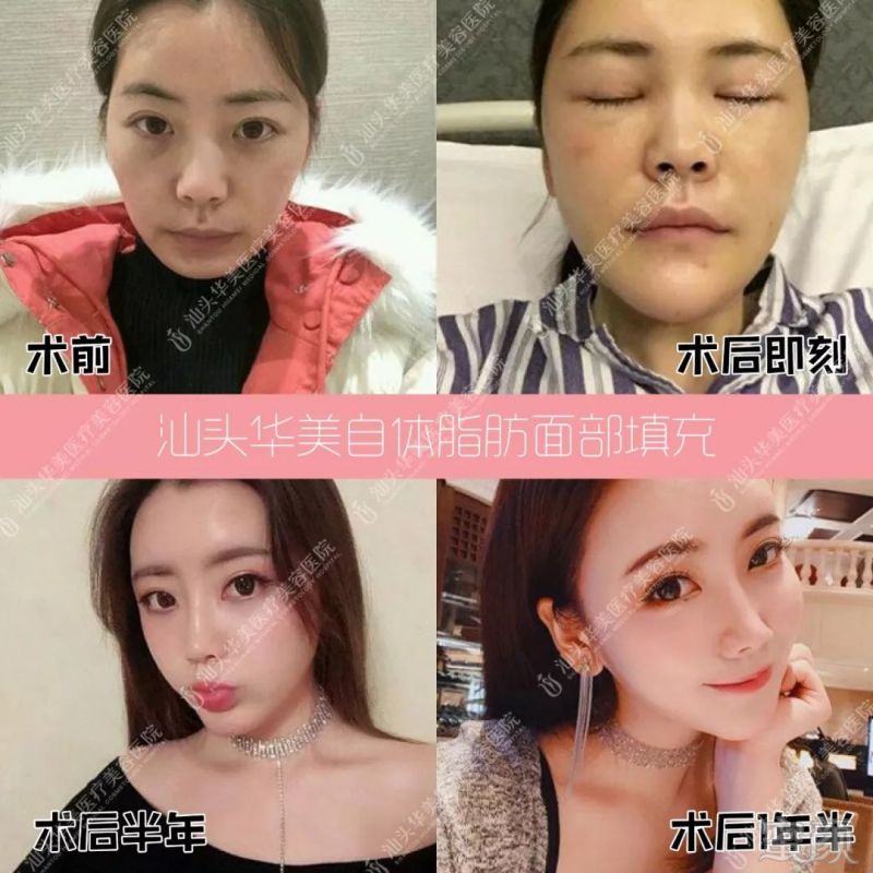 https://img.miyanlife.com/mnt/timg/190729/12052522Y-10.jpg