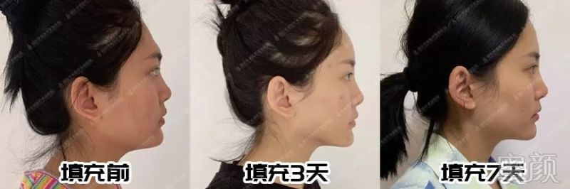 https://img.miyanlife.com/mnt/timg/190729/1205264061-11.jpg