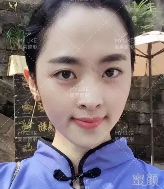 https://img.miyanlife.com/mnt/timg/190729/1224343542-0.jpg