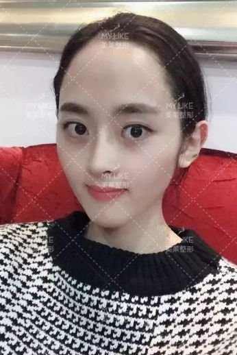 https://img.miyanlife.com/mnt/timg/190729/12243524Y-3.jpg