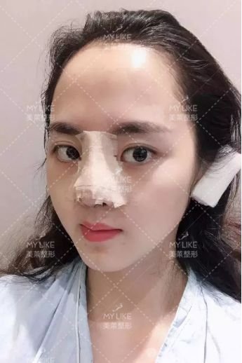 https://img.miyanlife.com/mnt/timg/190729/1224353Y8-2.jpg