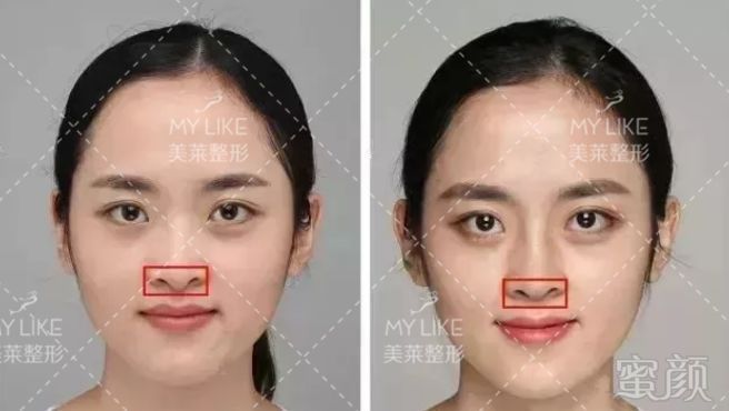 https://img.miyanlife.com/mnt/timg/190729/1224363Q4-5.jpg