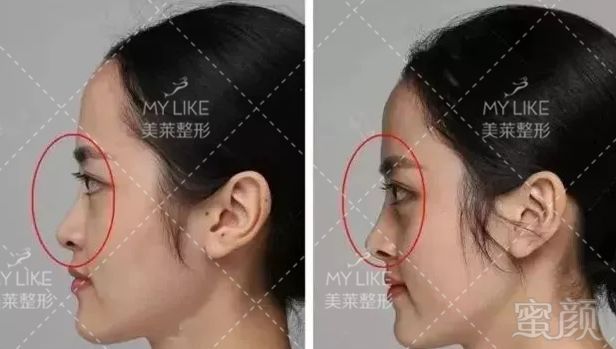 https://img.miyanlife.com/mnt/timg/190729/12243G564-7.jpg