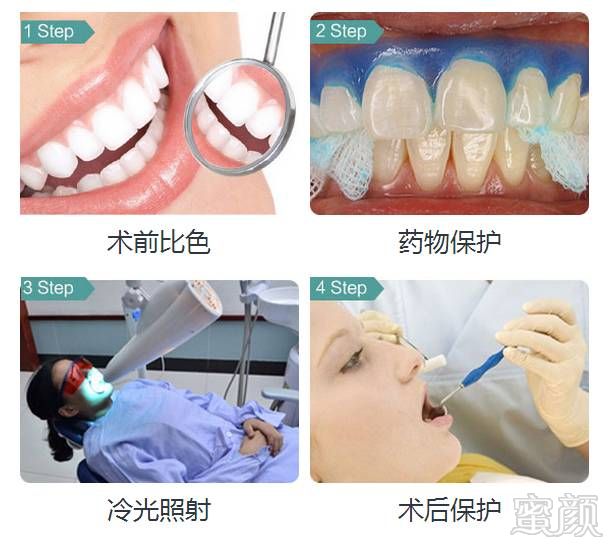 https://img.miyanlife.com/mnt/timg/190729/123S013H-9.jpg
