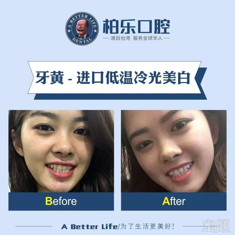 https://img.miyanlife.com/mnt/timg/190729/123S05D7-13.jpg