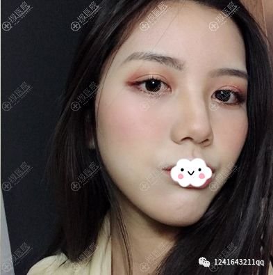 https://img.miyanlife.com/mnt/timg/190730/1145361591-1.jpg