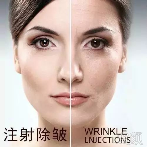 https://img.miyanlife.com/mnt/timg/190730/11524Q127-0.jpg