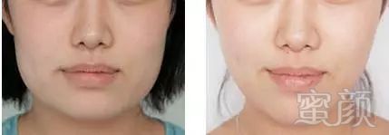 https://img.miyanlife.com/mnt/timg/190730/1152512194-5.jpg