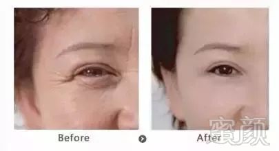 https://img.miyanlife.com/mnt/timg/190730/115251F52-4.jpg