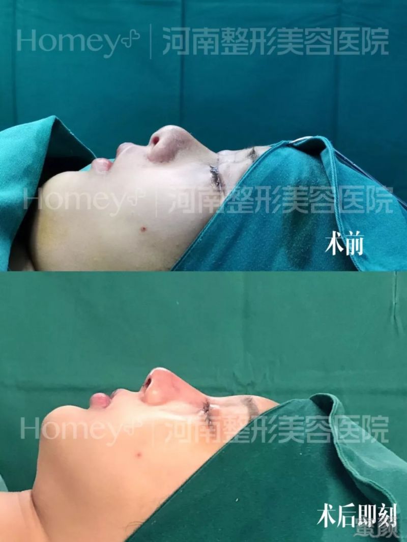 https://img.miyanlife.com/mnt/timg/190730/115409BV-8.jpg