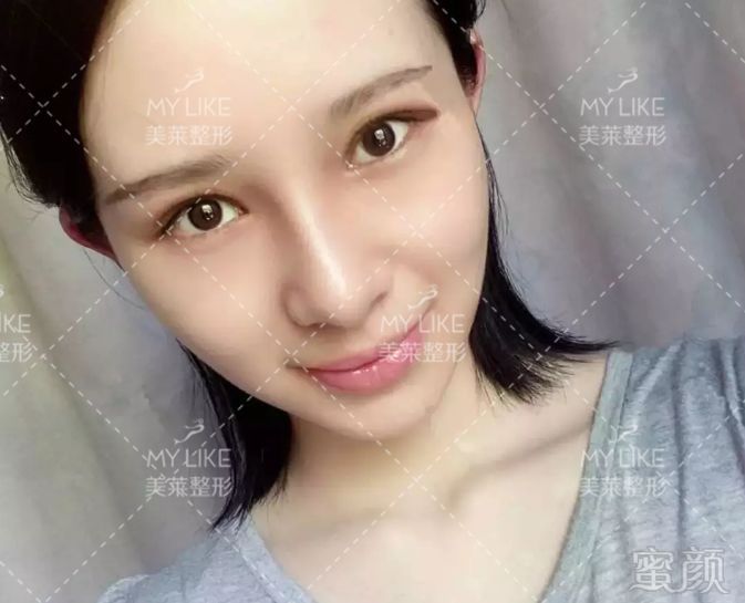 https://img.miyanlife.com/mnt/timg/190730/1203162508-0.jpg