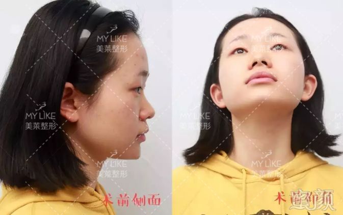 https://img.miyanlife.com/mnt/timg/190730/12031IA9-2.jpg