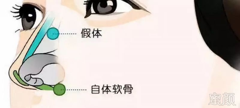 https://img.miyanlife.com/mnt/timg/190730/122JIK0-2.jpg