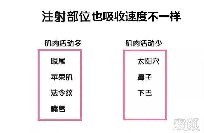 https://img.miyanlife.com/mnt/timg/190730/122U15a3-7.jpg