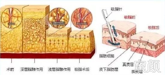 案例图片