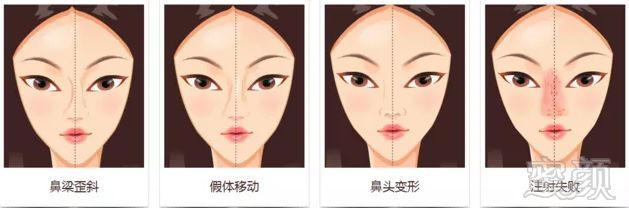 https://img.miyanlife.com/mnt/timg/190731/123241H93-2.jpg